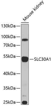 SLC30A1 Rabbit polyclonal antibody
