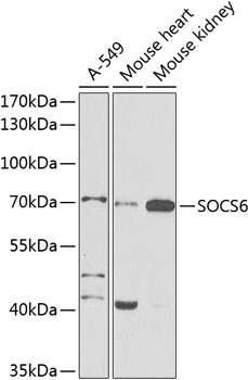 SOCS6 Rabbit polyclonal antibody