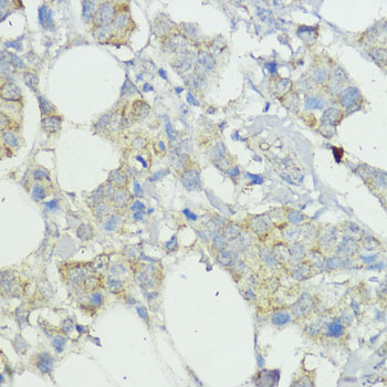 SOCS6 Rabbit polyclonal antibody