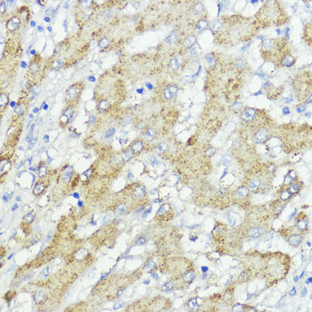 SOCS6 Rabbit polyclonal antibody