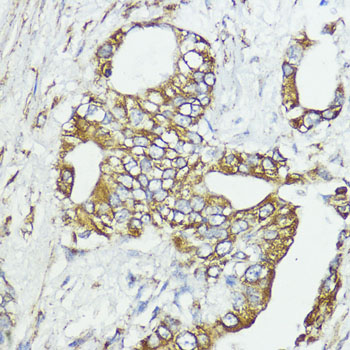 SOCS6 Rabbit polyclonal antibody