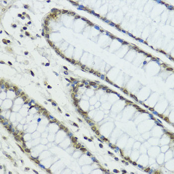 TRIP12 Rabbit polyclonal antibody
