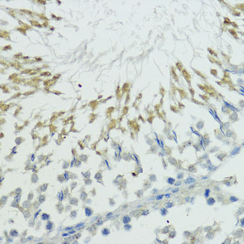 TRIP12 Rabbit polyclonal antibody