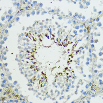 TRIP12 Rabbit polyclonal antibody