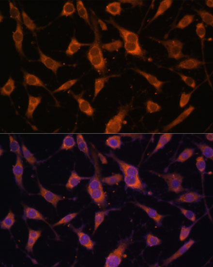 FBLN5 Rabbit polyclonal antibody