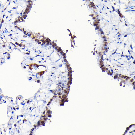 RGS14 Rabbit polyclonal antibody