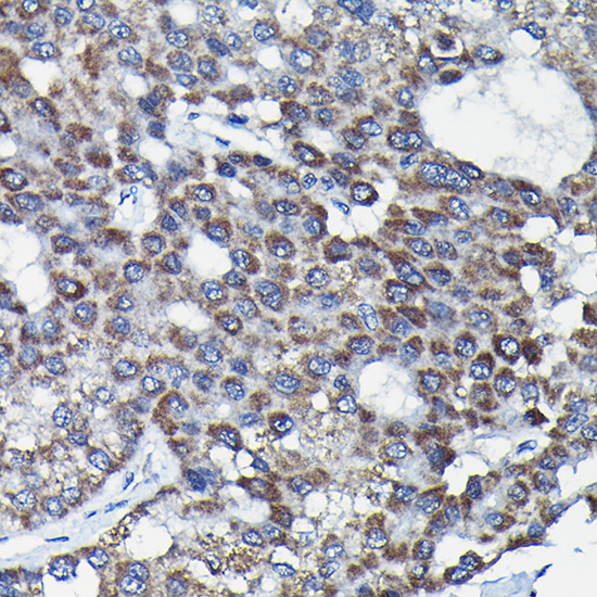 RGS14 Rabbit polyclonal antibody