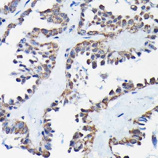 RGS14 Rabbit polyclonal antibody