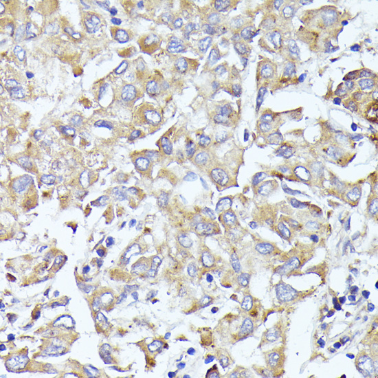EIF3L Rabbit polyclonal antibody