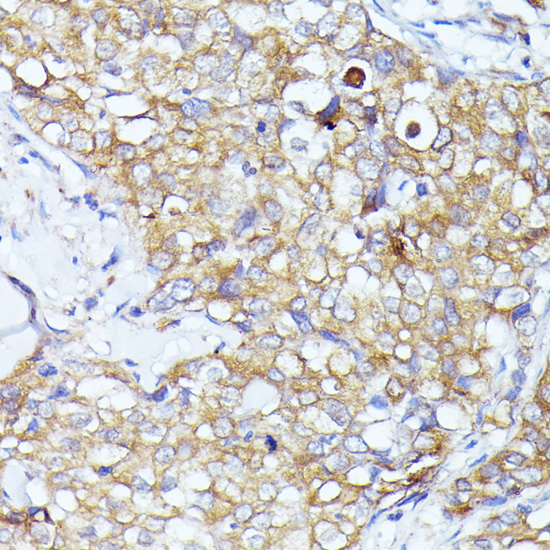 EIF3L Rabbit polyclonal antibody