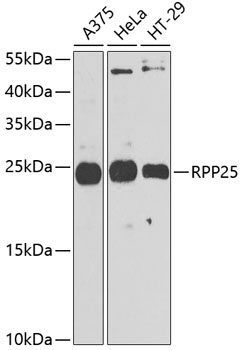 RPP25 Rabbit polyclonal antibody