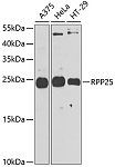 Western blot - RPP25 Rabbit pAb (A9973)