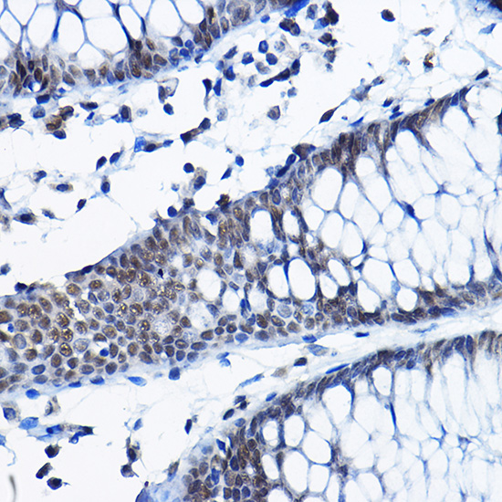 RPP25 Rabbit polyclonal antibody