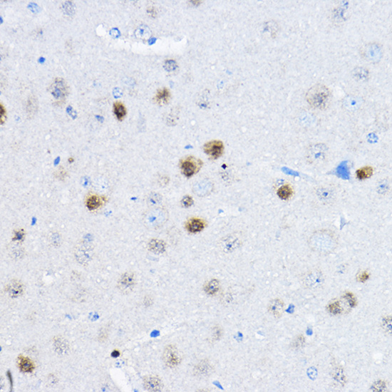 RPP25 Rabbit polyclonal antibody