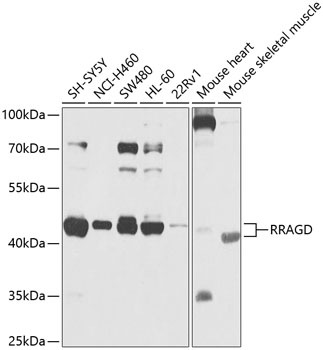 RRAGD Rabbit polyclonal antibody