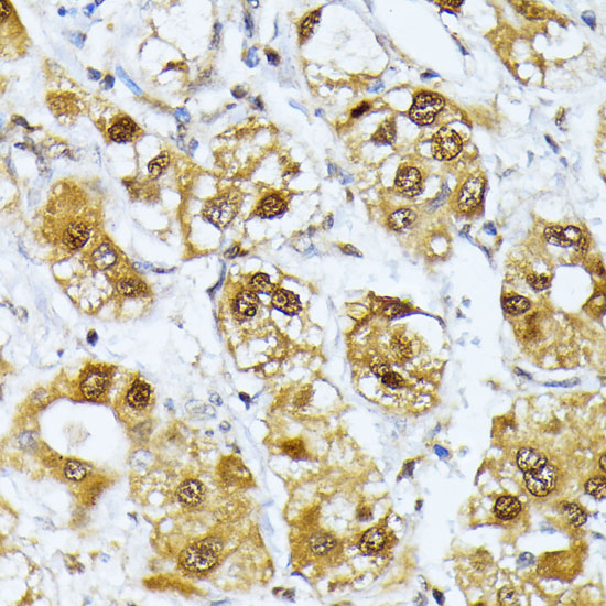 RRAGD Rabbit polyclonal antibody
