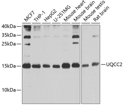UQCC2 Rabbit polyclonal antibody