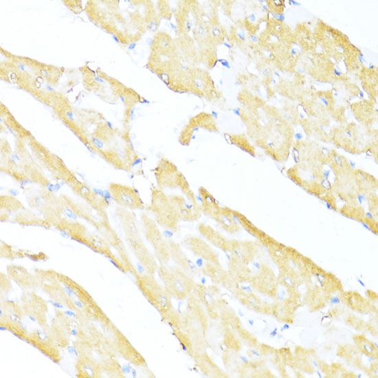 UQCC2 Rabbit polyclonal antibody