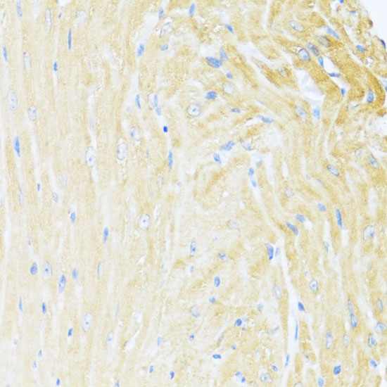UQCC2 Rabbit polyclonal antibody