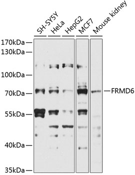 FRMD6 Rabbit polyclonal antibody