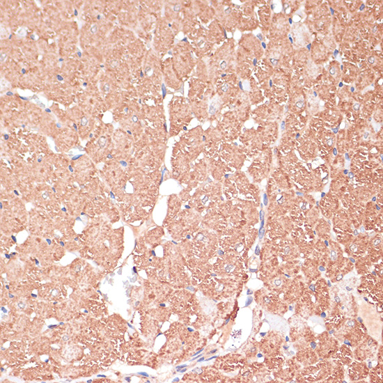 FRMD6 Rabbit polyclonal antibody