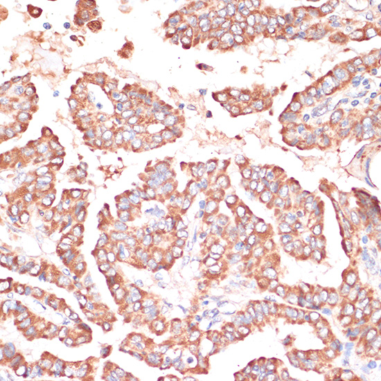 FRMD6 Rabbit polyclonal antibody