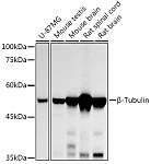 Western blot - β-Tubulin Mouse mAb (AC010)