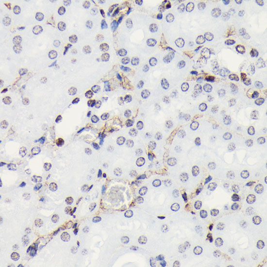 Phospho-Histone H3-S10 Rabbit monoclonal antibody