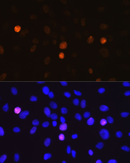 Phospho-Histone H3-S10 Rabbit monoclonal antibody