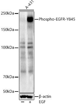 Phospho-EGFR-Y845 Rabbit pAb
