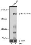 Western blot - Phospho-EGFR-Y992 Rabbit pAb (AP0026)