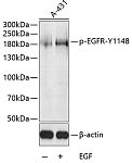 Western blot - Phospho-EGFR-Y1148 Rabbit pAb (AP0028)