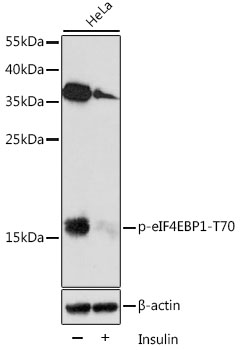Phospho-eIF4EBP1-T70 Rabbit pAb