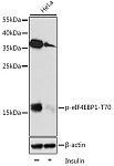 Western blot - Phospho-eIF4EBP1-T70 Rabbit pAb (AP0031)