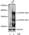 Western blot - Phospho-FGFR1-Y653 Rabbit pAb (AP0036)