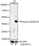 Western blot - Phospho-GSK3β-S9 Rabbit pAb (AP0039)