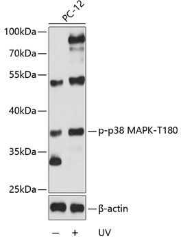 Phospho-p38 MAPK-T180 Rabbit pAb-Phospho-specific Antibodies