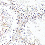 Western blot - Phospho-c-Myc-T58 Rabbit pAb (AP0080)