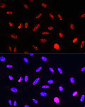 Western blot - Phospho-Histone H3-T11 Rabbit pAb (AP0093)