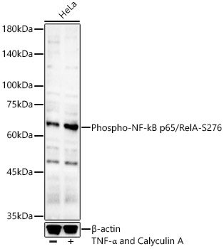 Phospho-NF-kB p65/RelA-S276 Rabbit pAb
