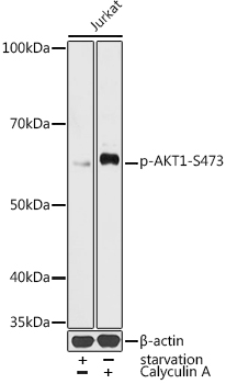 ABclonal:Western blot - Phospho-AKT1-S473 Rabbit pAb (AP0140)}