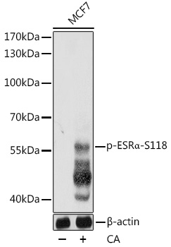 Phospho-ESRα-S118 Rabbit pAb
