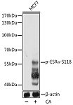 Western blot - Phospho-ESRα-S118 Rabbit pAb (AP0146)