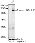 Western blot - Phospho-FOXO4-S197 Rabbit pAb (AP0177)