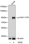 Western blot - Phospho-VAV1-Y174 Rabbit pAb (AP0180)