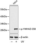 Western blot - Phospho-YWHAZ-S58 Rabbit pAb (AP0195)