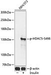 Western blot - Phospho-HDAC5-S498 Rabbit pAb (AP0202)