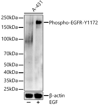 Phospho-EGFR-Y1172 Rabbit pAb