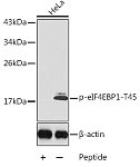 Western blot - Phospho-eIF4EBP1-T45 Rabbit pAb (AP0219)