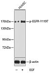 Western blot - Phospho-EGFR-Y1197 Rabbit pAb (AP0223)